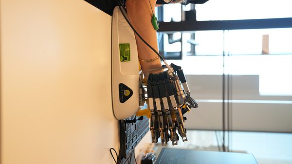 Hand-of-hope cihazı